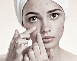 Que es el acné?? cómo tratarlo y controlarlo?? y cómo mejorar sus secuelas?