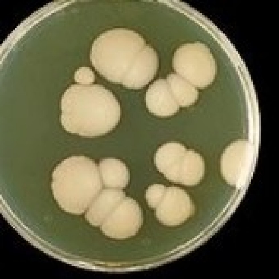 CÓMO CURAR Y PREVENIR LA CANDIDIASIS